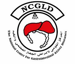 NCGLD